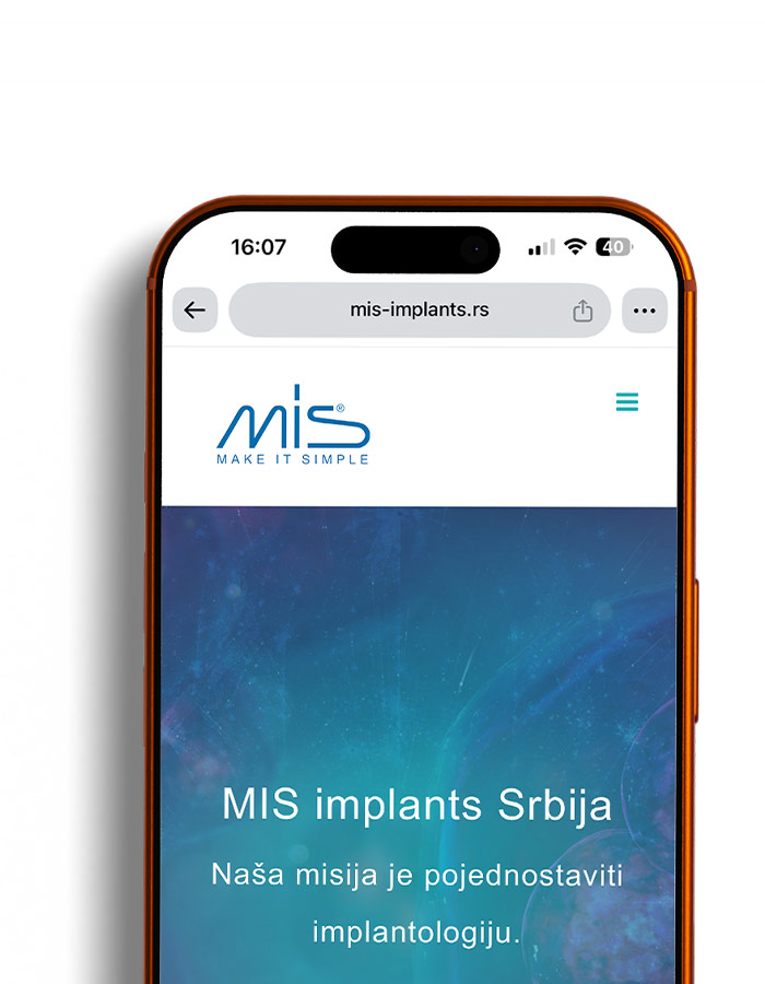 MIS Implants Srbija