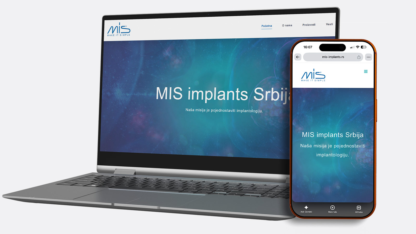 MIS Implants Srbija