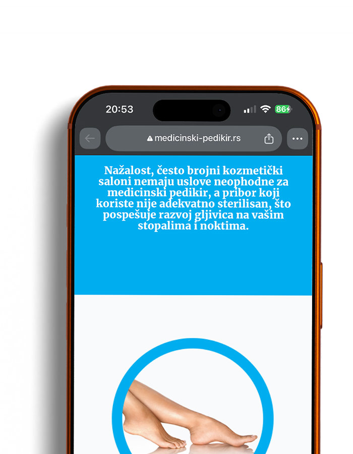 Pedikir-m-03 Medicinski pedikir